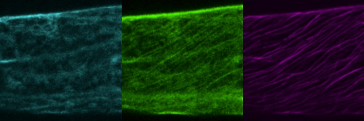 Ralph Hückelhoven (@huckelhovenr) on Twitter photo Ralph Hückelhoven
<a href="/HuckelhovenR/">Ralph Hückelhoven</a>
·
1 Min.
I would like to thank all my coworkers for getting this done. You and the nice big barley epidermal cells make my professional life a pleasure. ROP INTERACTIVE PARTNER b.... plantphysiol.org/content/early/… Ralph Hückelhoven
<a href="/HuckelhovenR/">Ralph Hückelhoven</a>
·
1 Min.
I would like to thank all my coworkers for getting this done. You and the nice big barley epidermal cells make my professional life a pleasure. ROP INTERACTIVE PARTNER b.... plantphysiol.org/content/early/…