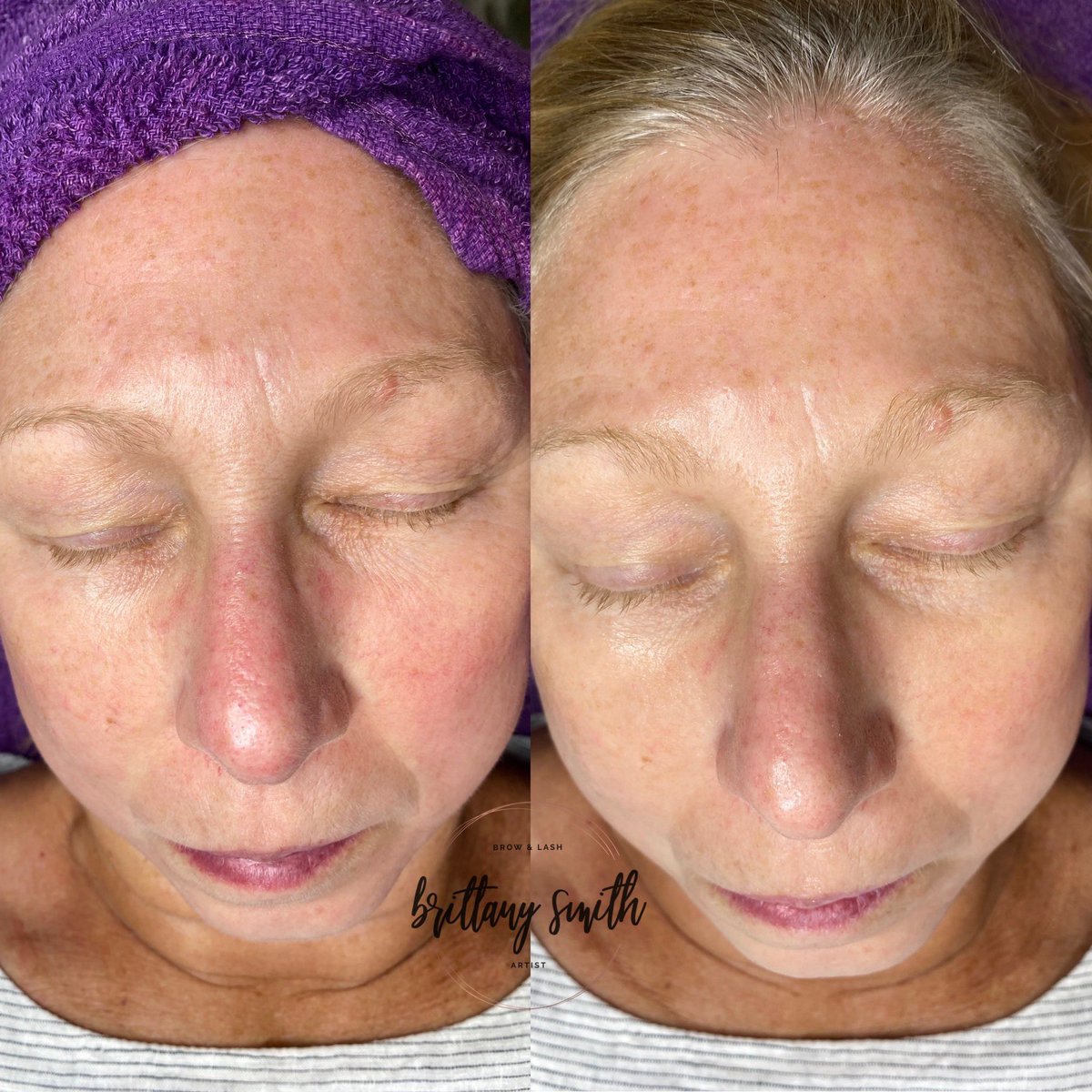 ____bls's tweet photo. 🚨reduce the appearance of fine lines &amp; pores, dead skin &amp; vellus hair(peach fuzz) INSTANYLY 🚨 ask me how! https://t.co/44ifrwM8tm