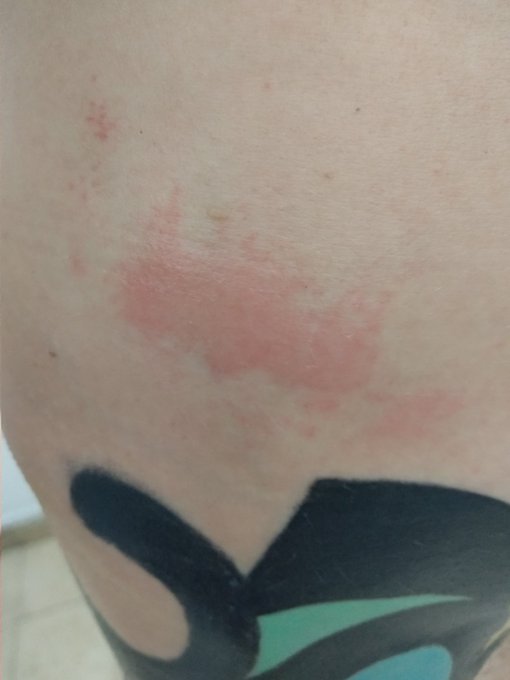 #legfetish #tattood #jiujitsu #findom just came from training. All my body looks like I'm after #impactplay<a href="/tag/legfetish"class="tags">#legfetish</a><a href="/tag/tattood"class="tags">#tattood</a><a href="/tag/jiujitsu"class="tags">#jiujitsu</a><a href="/tag/findom"class="tags">#findom</a><a href="/tag/impactplay"class="tags"><span>#impactplay</span></a>