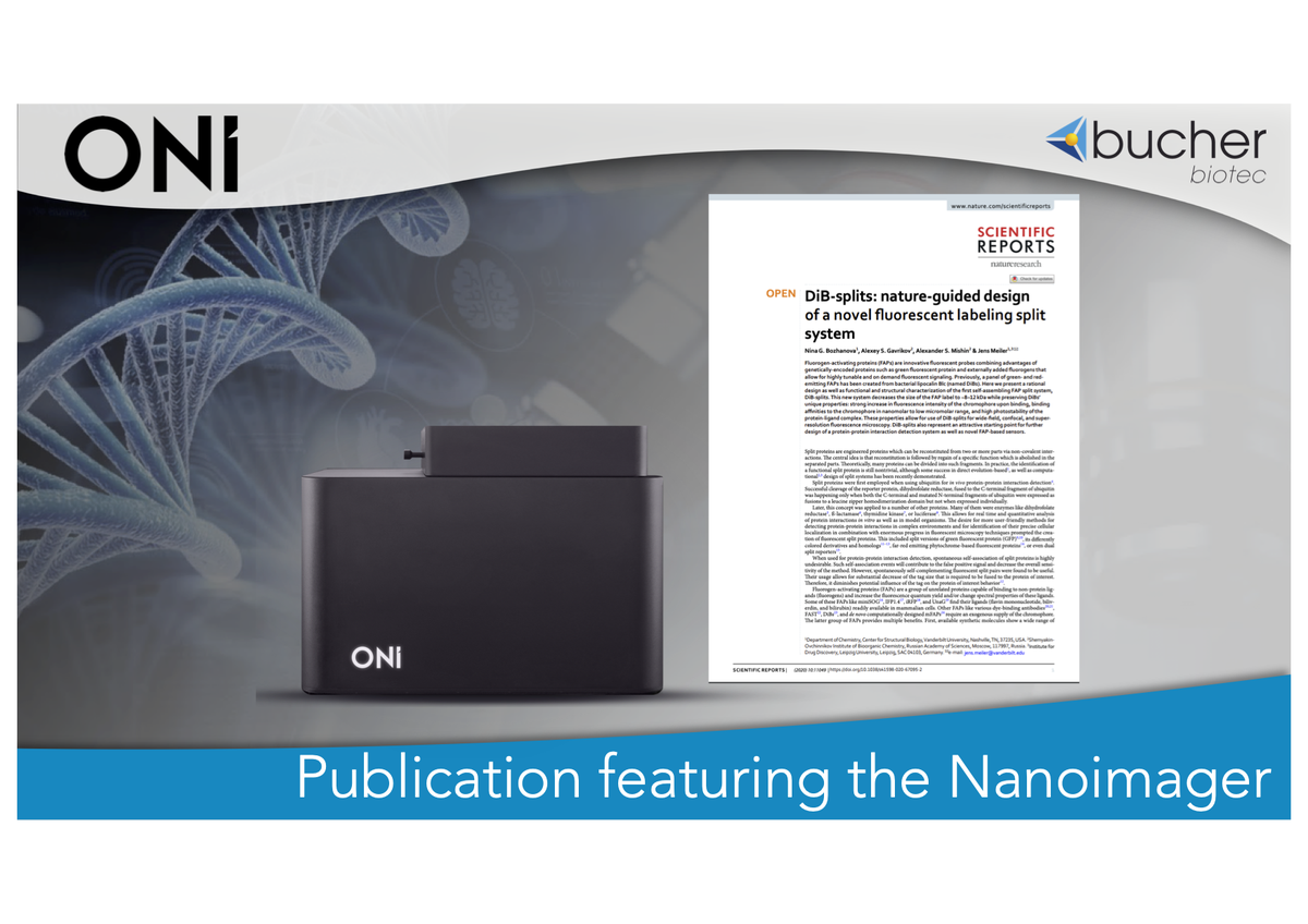 BucherBiotec's tweet photo. Exciting advances in the generation of a novel fluorescent labeling split system! Using the #Nanoimager from @oniHQ , Jens Meiler and his team demonstrate the #SingleMoleculeLocalization in living cells. ๐ฌ Amazing work! ๐ Check out the paper here
โก๏ธ https://t.co/N6uO5FuCMj https://t.co/ivbcE2DP73