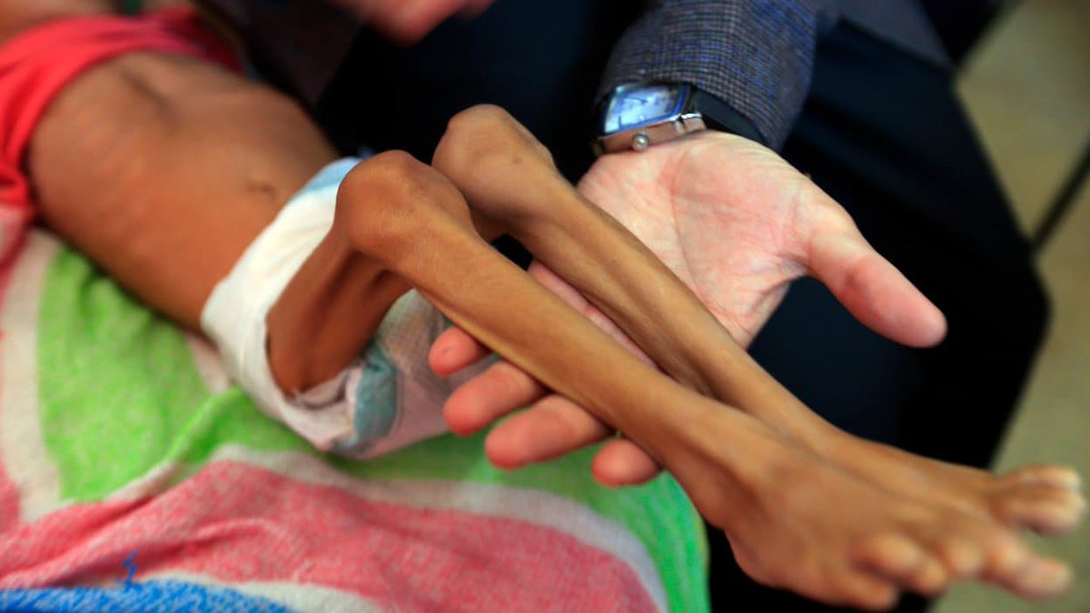 BFMTV's tweet photo. ALERTE INFO. La faim dans le monde s'est aggravée en 2019, et la situation devrait s'empirer en 2020
 https://t.co/NdgdJtUVxe https://t.co/HAIZGjvN0Z