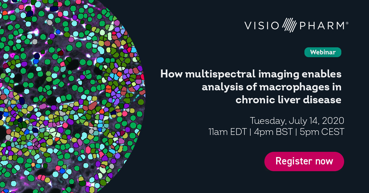 Visiopharm's tweet photo. Interested in getting the full picture of the #tissuemicroenvironment? Join Dr. Heather Stevenson's webinar & learn how to optimize #multiplexstaining
https://t.co/HK47FIwqTn
#immunology #AI #digitalpathology #spatialanalysis #biomarkeranalysis @DrHSLovesLiver https://t.co/LNmjJqFOwU