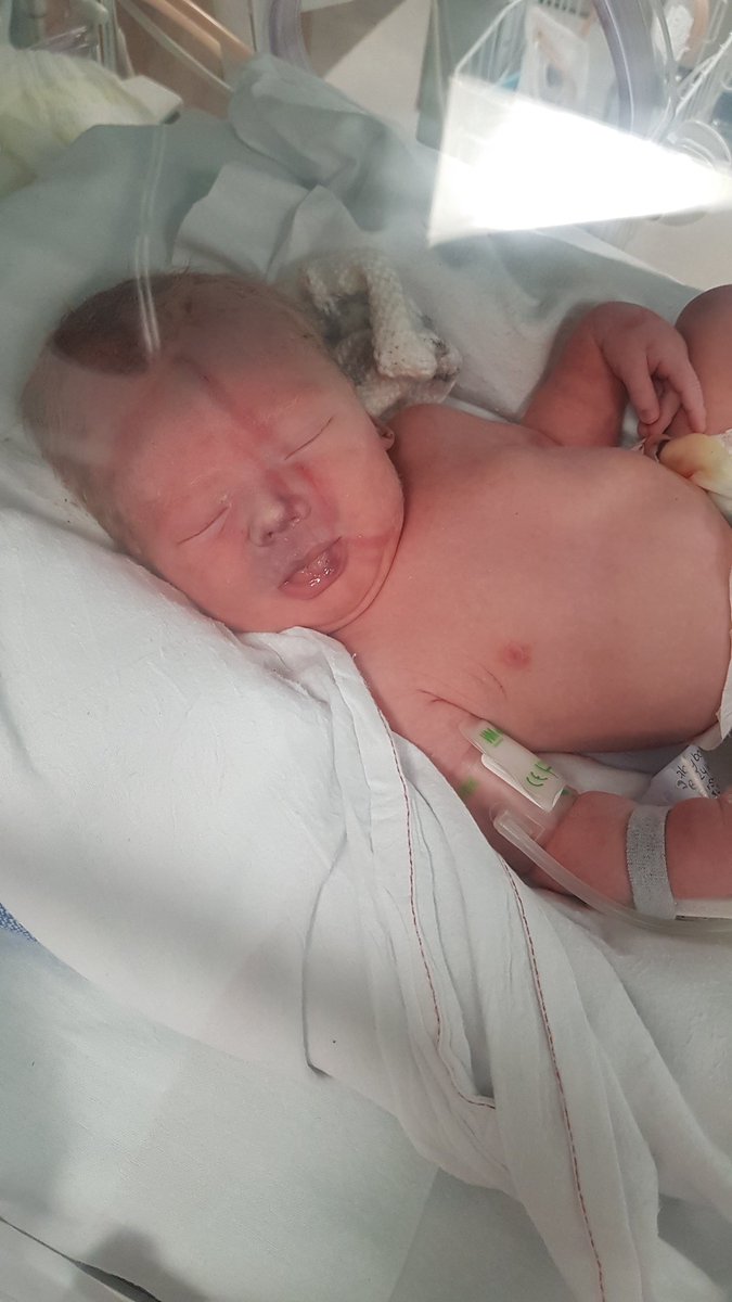 Grandenko1's tweet photo. Just over a year ago our little human was born. 
Due to complications we had to transfer over 200 miles from home and had nowhere to stay.
@RMHCUK had room for us and allowed us to stay for 8 days while our baby recovered.
Thank you for helping us when we had no idea what to do. https://t.co/DmwOyq8dzE