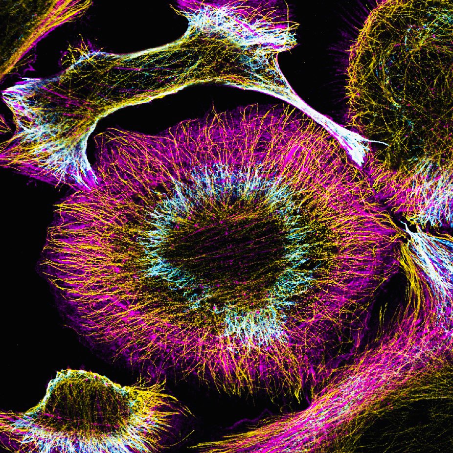 drlornayoung's tweet photo. Look at the bones! #microtubulemonday #montymonday #mediocremonday https://t.co/wbh3gEUxVm
