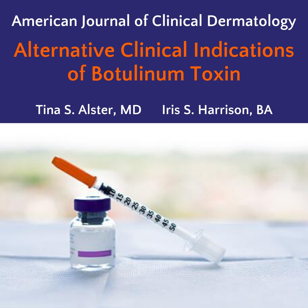 We are excited to announce the publication of "Alternative Clinical Indications of Botulinum Toxin" in the American Journal of Clinical Dermatology (Springer Nature). This review outlines the clinical use of #botox beyond wrinkles. Link - rdcu.be/b5y0j
#dermatology