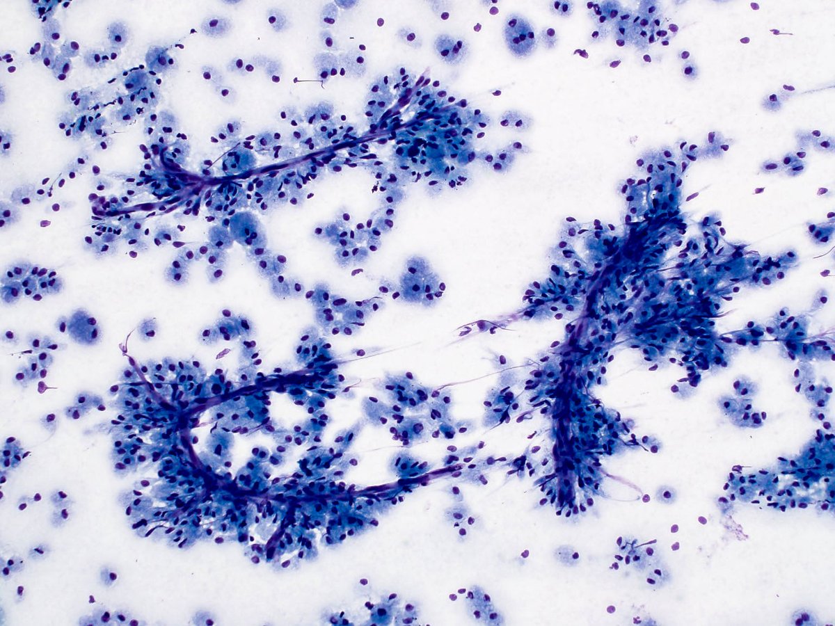 Chris VandenBussche tweet media