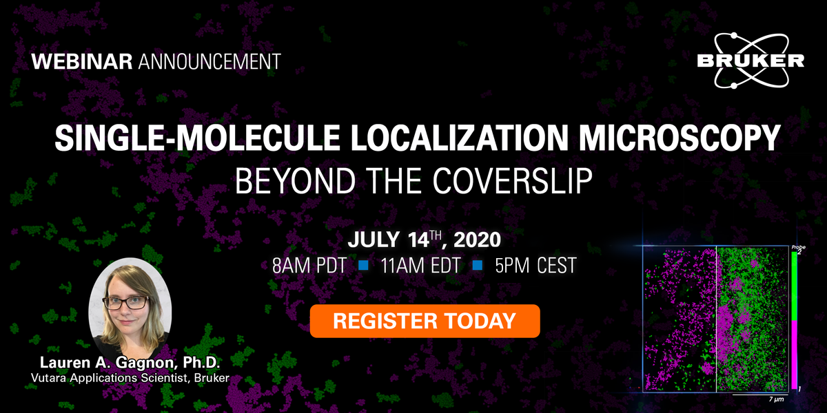 BrukerNano's tweet photo. Don't miss tomorrow's webinar! Go beyond the coverslip with #singlemoleculelocalization #microscopy (SMLM) and see examples demonstrating the use of Vutara 352! ๐ https://t.co/1Bs9e1mmdl https://t.co/WAeJbK0blf