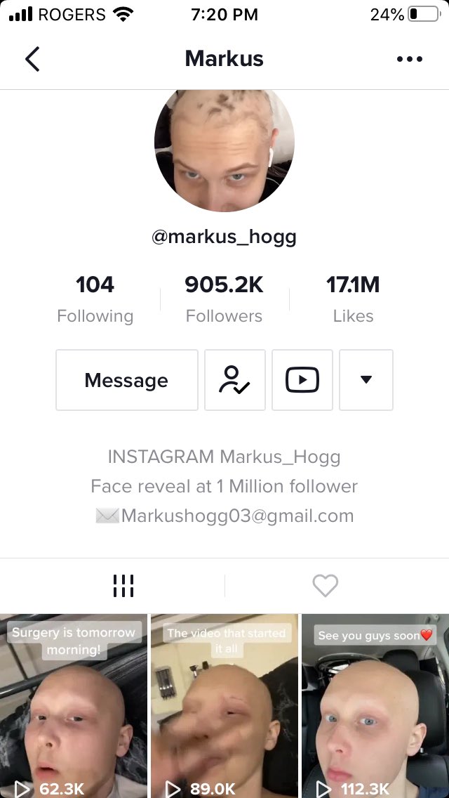 Iluvskris's tweet photo. Second time battling cancer. Surgery tomorrow. Please pray for him. He wants to get to a million TikTok followers. #MarkusStrong https://t.co/MzdUz9OZ9N