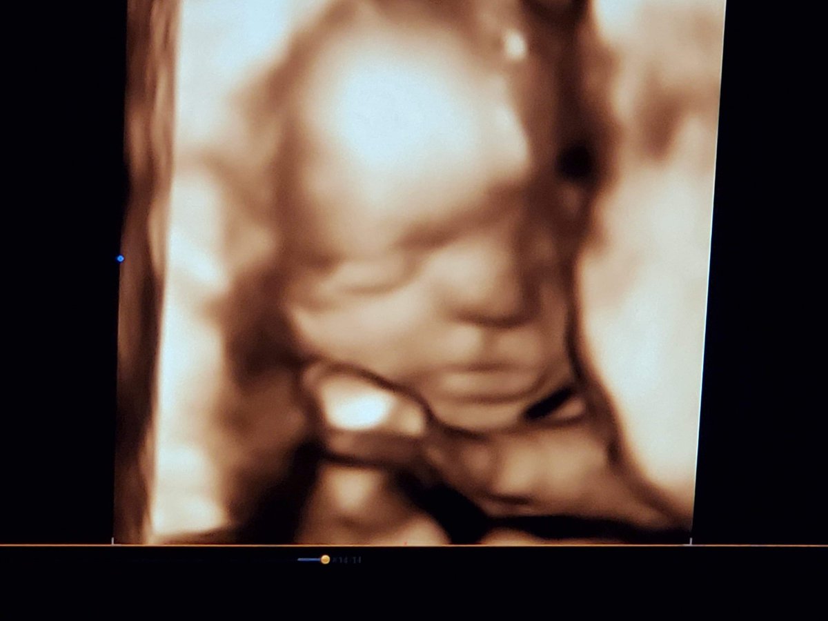 John05292178's tweet photo. My daughter voilet jane denhart its been a long road princess and daddy cant wakt to meet you #Daughter #babygirl #15weeksleft #octoberbaby #21st https://t.co/s0gWtH5od3
