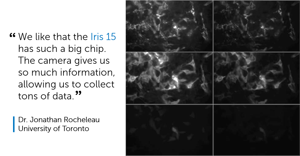 Photometrics's tweet photo. Our thanks to Dr. Jonathan Rocheleau for sharing the story of how they're using the #Iris15 for high content imaging! Read the full story here: https://t.co/ijfb784Zqg https://t.co/zHpsj184bL