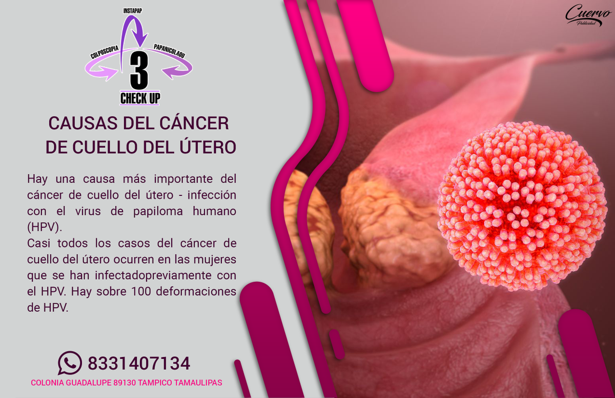 instapaptam's tweet photo. 👩🔬👨🔬 Causas del cáncer de cuello del útero👩⚕️👨⚕️
🛑 Te recordamos que tenemos estrictas medidas de higiene para tu mayor seguridad.
☎️Citas:
833 241 23 86 o 833 140 7134
#Tampico #Madero #Altamira #Medico #Salud #Mujer #Instapap #CheckUp #CáncerDeCuellodelUtero https://t.co/ZMelMIE3xw