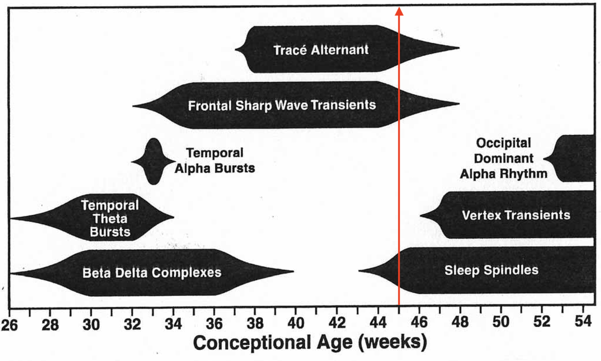 Let's now answer the bonus question: when do SS appear? Most authors point to emergence between 44-46 weeks postconceptional age. See Libenson (blue) and Hrachovy atlas (black) diagrams for reference. I love keeping these handy, you should too!