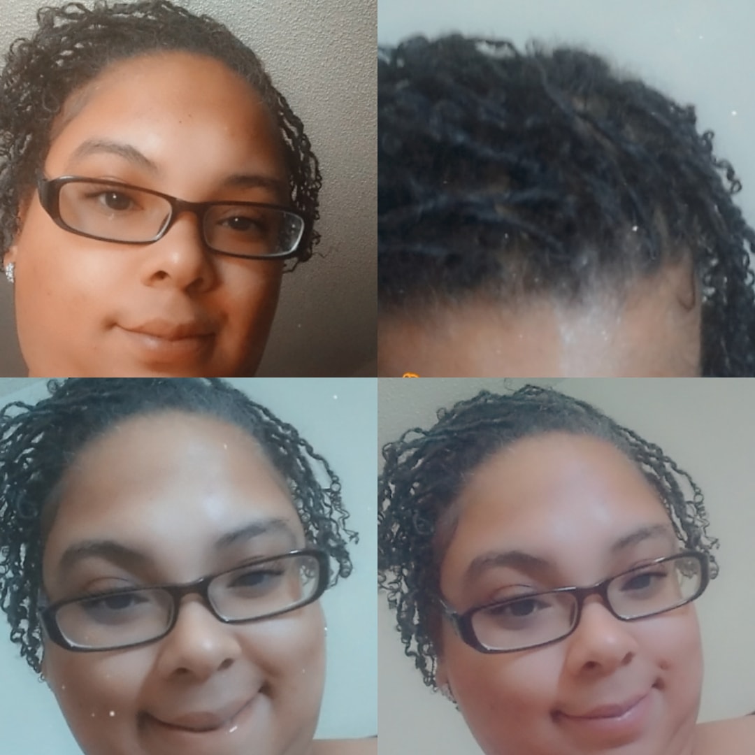 lilmamaGOODY's tweet image. Stepping into month 2 of my loc journey 🙌 and I'm LOVING IT 
I'm embracing the fizzy , the shrinkage , the wilderness 
Best hair decision ever 😍 
#locs #locd #locdandloaded #locdlife #lifestyle #womenwithlocs #locdandcommited #2monthsold #NaturalBeauty #naturalhair #staywoke