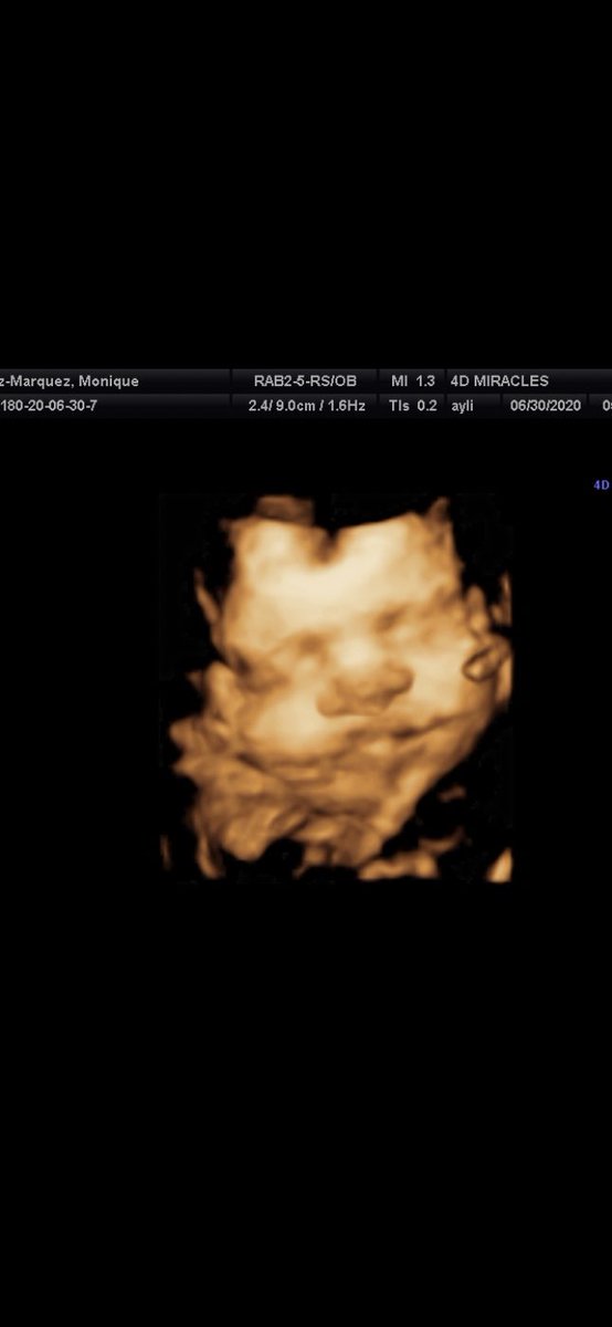 mmarquez_'s tweet photo. who i’m doin it for , my world 🌎 biggest and greatest blessing 🦋 https://t.co/zzIi7W4s39