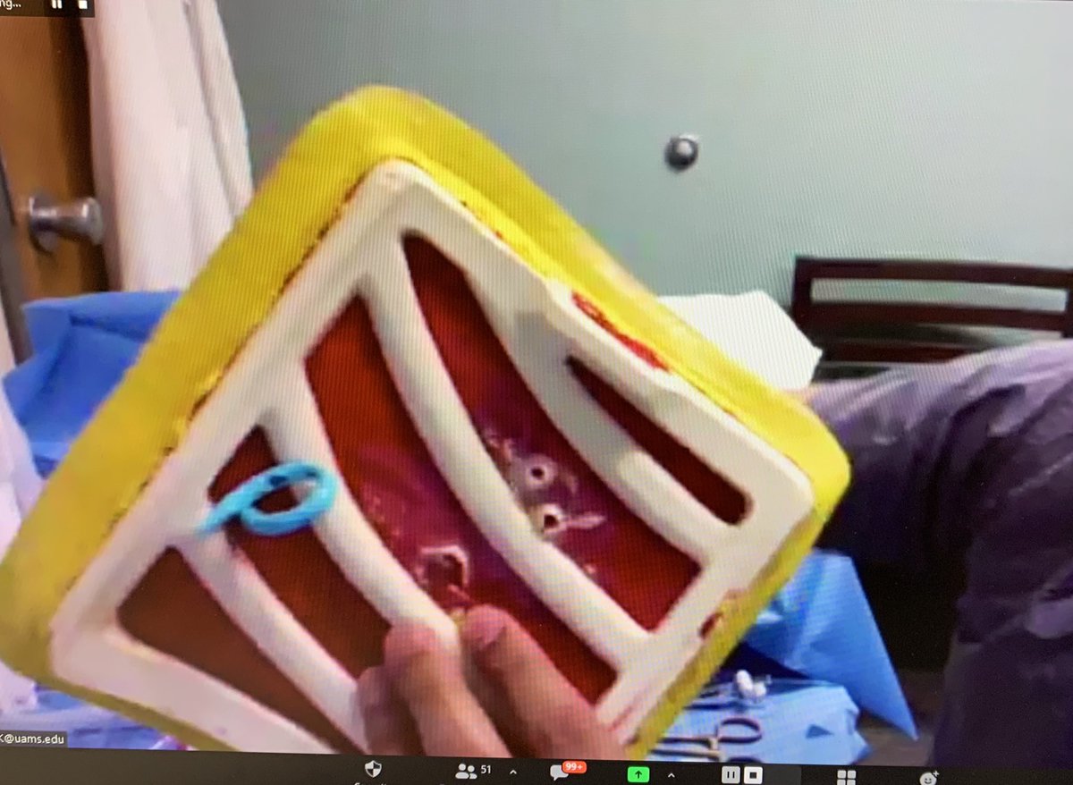 sfaiz212's tweet photo. Up next @Donicme with live demonstration of #ChestTube #Pleura #SWRegBootcamp and a stylish π π§’ View from the inside https://t.co/a428RwMFnn