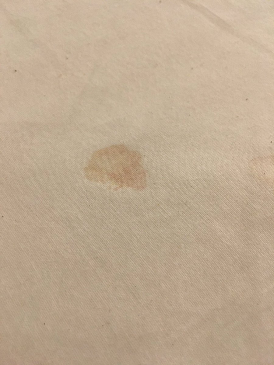 CSAdvocateMatt's tweet photo. @TurnKeyVR had dirty vacation. Unit not COVID cleaned. Towels smell cigs. Sheets had dried blood and sand. Trash left in room. Can’t get resolution for refund. See previous guest comment too! Help!!! https://t.co/HL0gwaWpyv