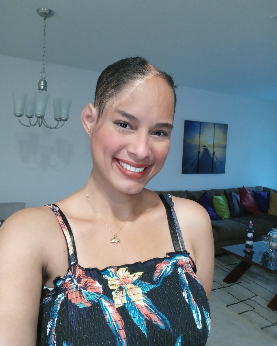 WadskierOriana's tweet photo. Venezuela mía. Te amo. Quiero verte libre y soberana. Ninguno de mis paisanos merece vivir lo que viven. 

Yo tengo la firme convicción de que a Venezuela le pasará como a mí. Se recuperará y saldrá adelante con ímpetu y gallardía. Que Dios les siga dando fuerzas para soportar. https://t.co/ku3HEJb4OM
