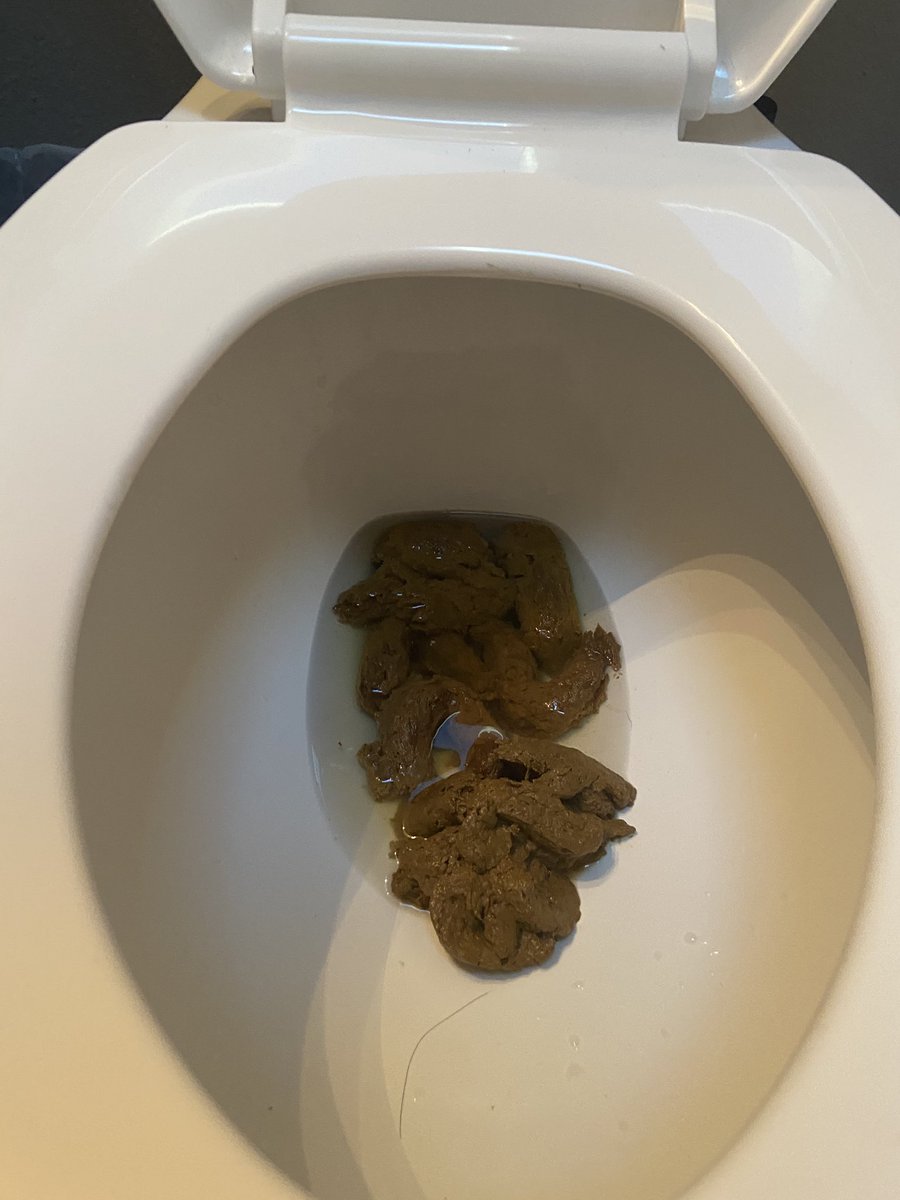 LogGoddess's tweet photo. I just nuked my toilet with this insanely mushy and gassy megadump 🥰 Posting the video tonight ❤️ This felt so fucking good coming out, I’m still wet 😍

#scat #female #hyperscat #megadump #chubby #scatfetish #eproctophilia #toilet #cloggedtoilet #fart #farting #ass #diarrhea https://t.co/kNFC7Q5nqq