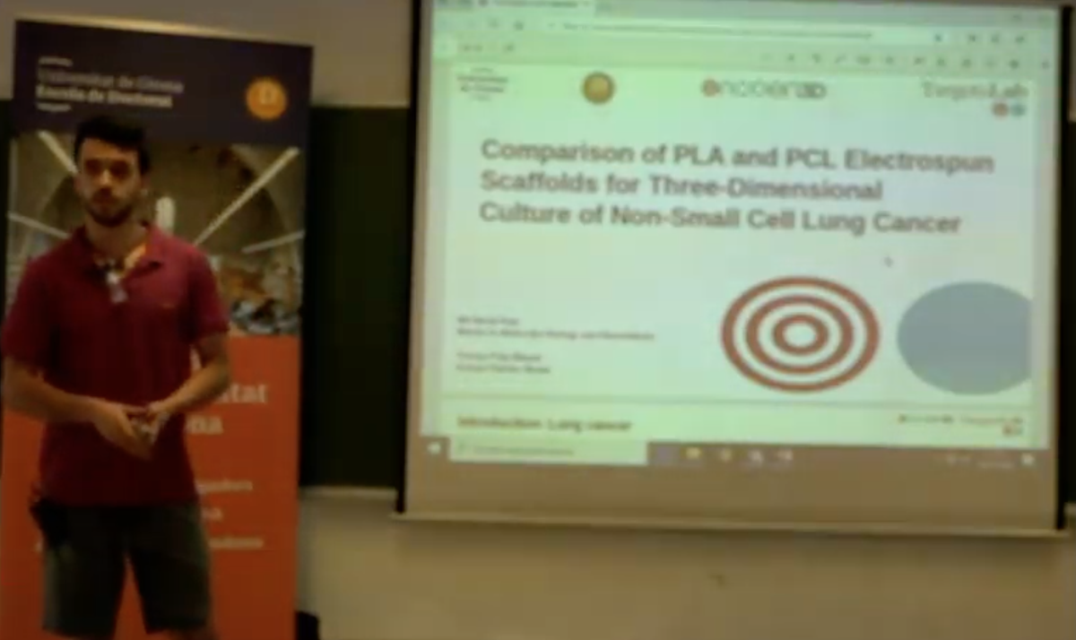 En Nil Naval (Màster en Biologia Molecular i Biomedicina, <a href="/UdGCiencies/">Facultat de Ciències</a>, TargetsLab, GREP) ens parla de l'ús de biopolímers en el càncer de pulmó. #JoDoc2020 
<a href="/TPuigMiquel/">Teresa Puig Miquel</a> <a href="/QuimCiurana/">Quim Ciurana</a> <a href="/udgmasters/">UdGmasters</a>