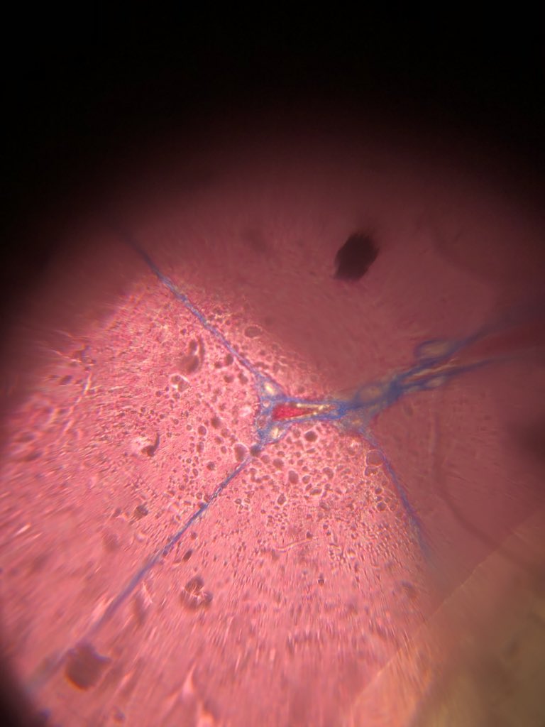 Tag 18: Danke <a href="/Ind137/">Herr R. NRW</a> 😍 für die Idee. Das Foldscope ist angekommen und zusammengebaut🤓 #Physik #Bio #Naturwissenschaften #foldscope #twlz