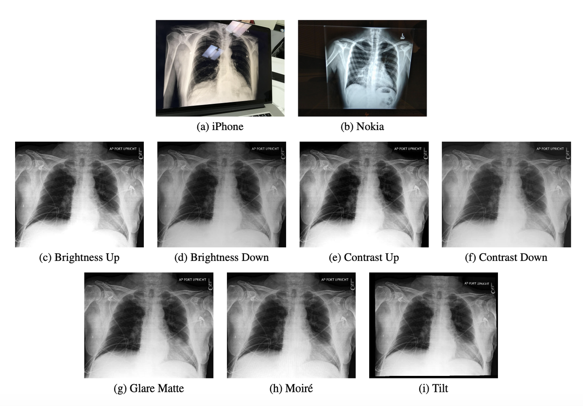 Pranav Rajpurkar Excited To Share Our Latest Research Efforts In Ai Medicine Introducing Chexphoto A Dataset Of 10 000 Photos Of Chest X Rays For Benchmarking Deep Learning Robustness T Co 0dkmymayym W Nphill22
