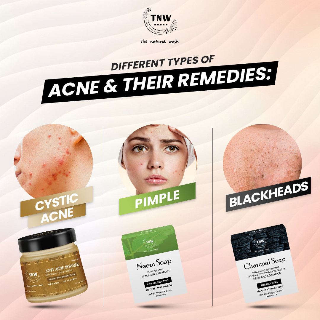 thenaturalwash_'s tweet photo. For treating your acne right you need to know its type right! Here are 3 different types of common acne to help you choose the correct remedy.
Shop https://t.co/upXWiG2ORS
#tnw #thenaturalwash #ayurveda #sulphatefree #parabenfree #crueltyfree #typesofacne #antiacne #tuesdayvibes https://t.co/Nsi7Cqo2Xx