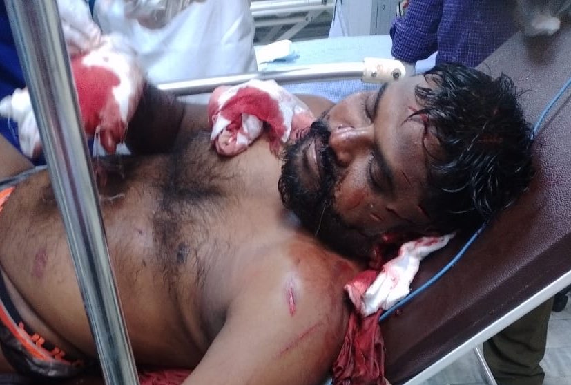 I strongly condemn the attack on <a href="/BJP4Andhra/">BJP ANDHRA PRADESH</a> karyakarta, K. Narayana Rao by the hooligans of <a href="/YSRCParty/">YSR Congress Party</a> in Vijayanagaram

What was his mistake? 

Being active in service activities? Helping the needy? And sanitising the local area with permission of municipal commissioner?