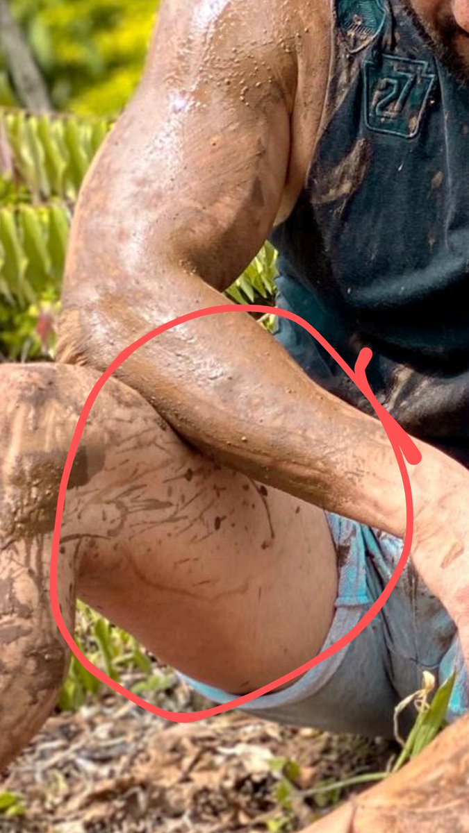 heavensbutcher's tweet photo. @BeingSalmanKhan @NagpurKaRajini You rubbed mud in your face but forgot your legs!
Itna Overacting mat kar!
@TeamKangna #SushantSinghRajput #KanganaRanaut https://t.co/40Uuwb4rEj