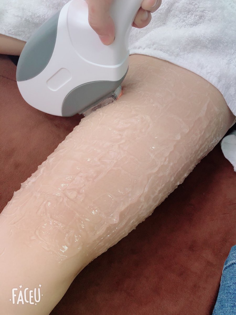 CEstetician's tweet photo. 📣🔥Portable E-light(IPL+RF)  Professional Hair Removal Skin Rejuvenation Permanent Hair Remover

#Elighthairremoval #acnetherapy #pigmentremoval
#Vasculartherapy #skinrejuvenation #wrinkleremoval
#IPL #rf #640nm #560nm #carolesthetician https://t.co/3QW0Hb02aB