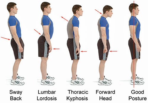 FlexAbleStretch's tweet photo. Most people tend to suffer from bad posture due to their job or exercising.  Posture is only fixed through habits that involve stretching or corrective movements.  Here at Flex-Able we can offer stretching therapy and corrective exercises that can make your work day better! 🔥🔥 https://t.co/nIxLFSWZLD