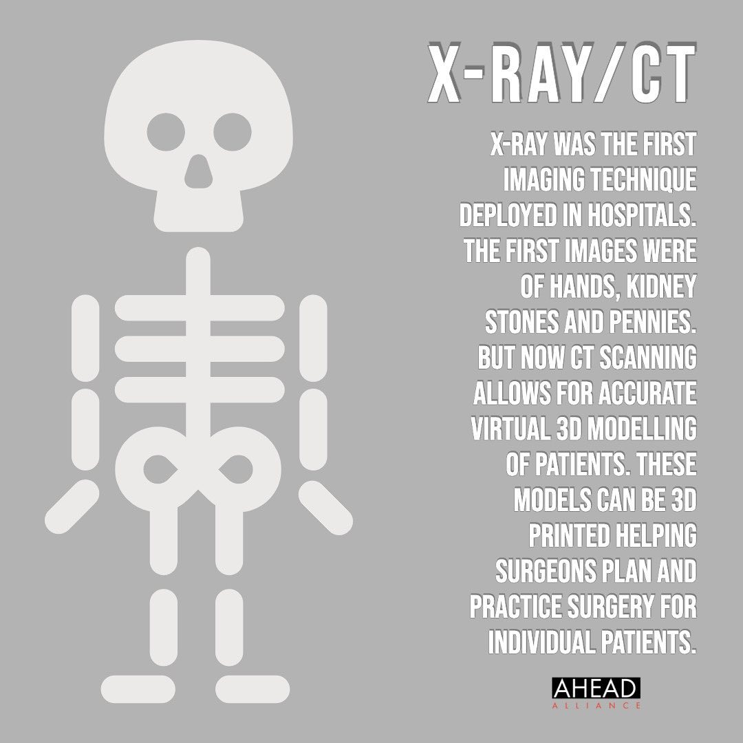 ahead_alliance's tweet photo. X-ray and CT are imaging techniques that are essential to diagnosis, treatment, and monitoring or patients. Development of these imaging techniques over the years mean that clinicians can plan ahead and make better…

📸 https://t.co/3xqzxqxoR8 via https://t.co/pRbQ6JvMcs https://t.co/MnLBA6IuPZ