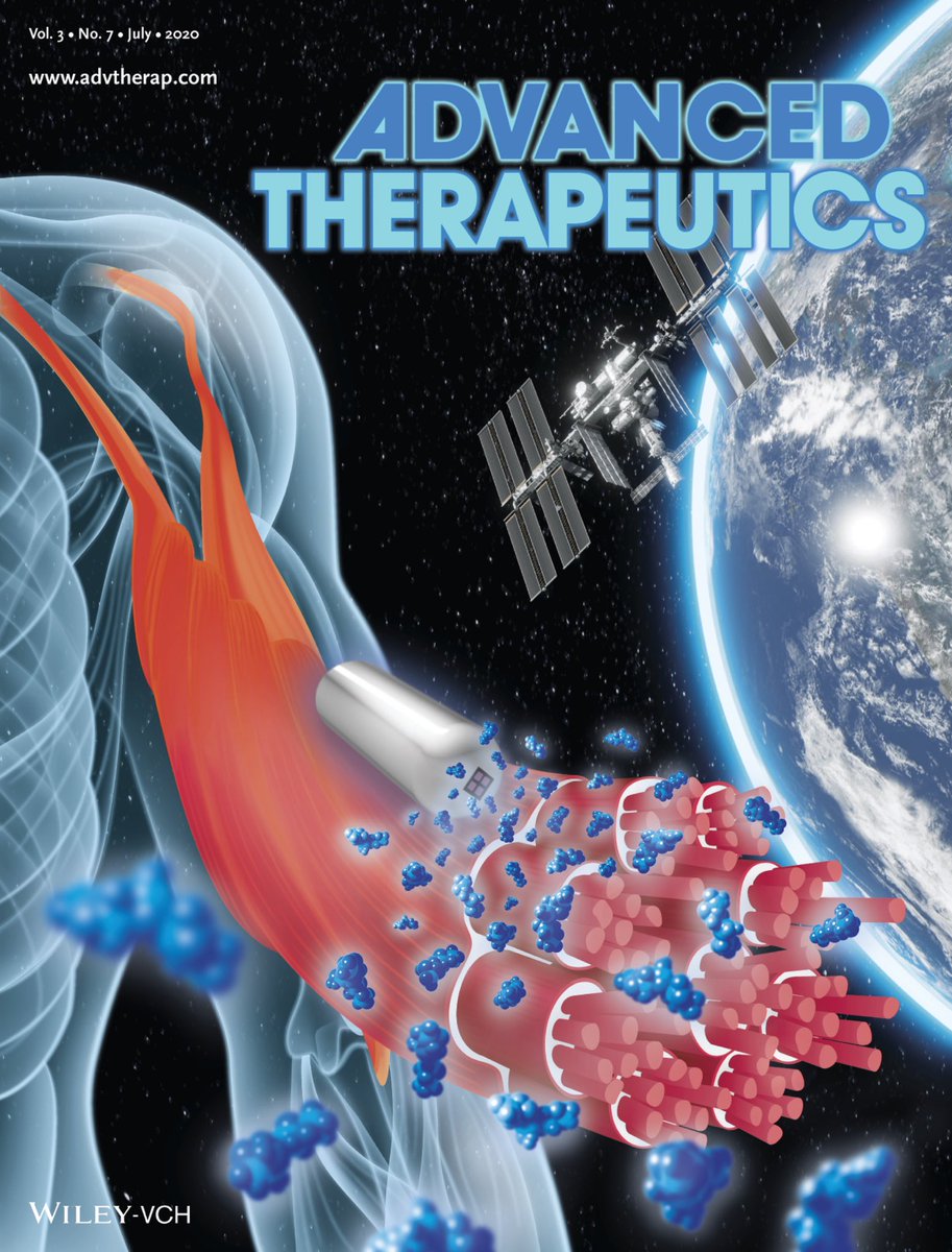 GrattoniLab's tweet photo. We're proud to share our front cover art for Advanced Therapeutics journal! Here we depict our nanofluidic delivery device for the muscle atrophy prevention project aboard the @Space_Station. @ISS_CASIS @NASA #grattonilab #science #ScienceTwitter @WileyGlobal https://t.co/YCOAMjjZEh