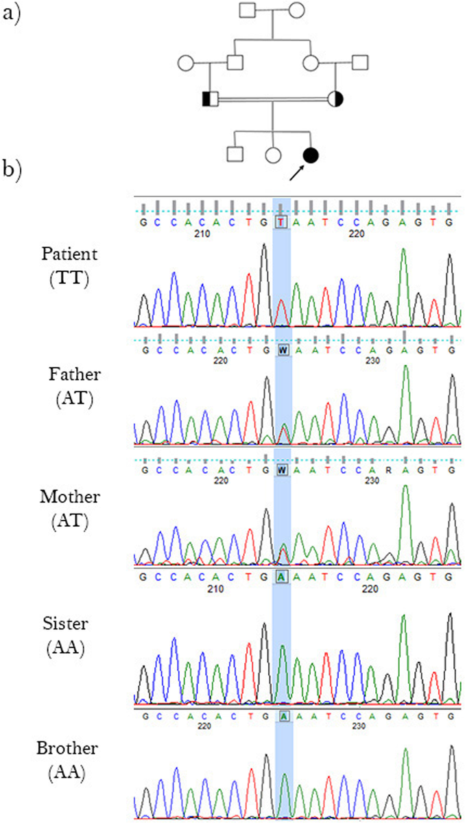 ensembl's tweet photo. A novel stop-gain #mutation in #DPYS #gene causing Dihidropyrimidinase deficiency.
@BioMedCentral @OAgenetics

https://t.co/Qj8OD5mMvM
#CitedEnsembl #UsingVEP #EnsemblVEP https://t.co/3REovVEoJN