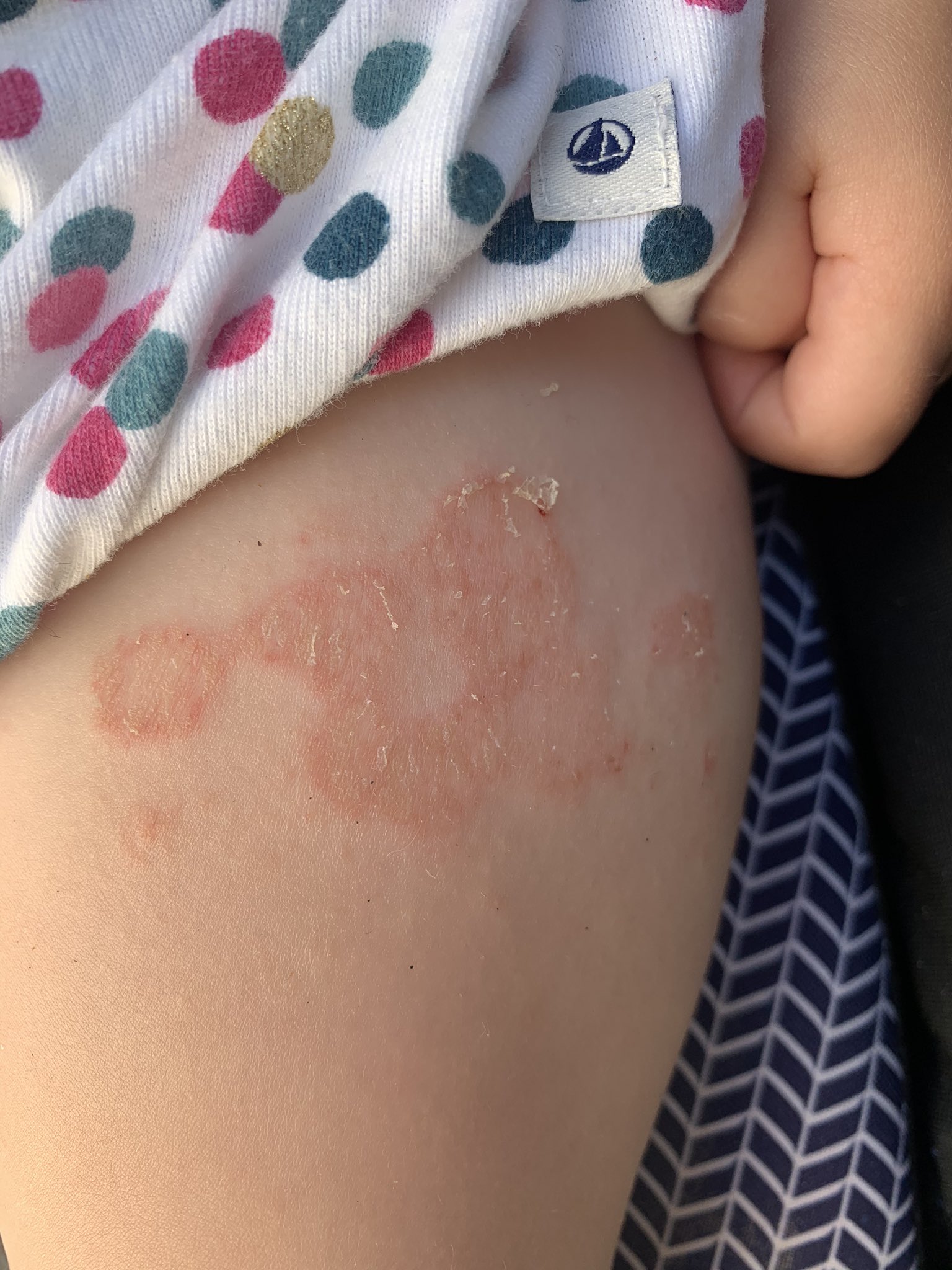 La Baronne Doctoctoc Ca Vous Fait Penser A Quoi Les Docs Bebe De 15 Mois Pas D Aeg Ni Fievre Dure Depuis 1 Semaine