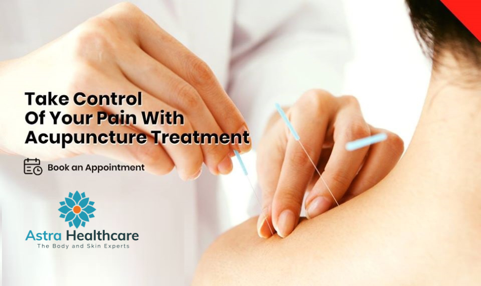 AstraHealthcare's tweet photo. #Empower your life with acupuncture treatment! @AstraHealthcare our professional therapist help you to #manage your chronic pain with ease.

Call for FREE CONSULTATION @ 905-458-3400 Or Book an appointment today at visit https://t.co/vqLVKJtnlI

#Acupuncture #Acupuncturetherapy https://t.co/DHAqAdsWPa