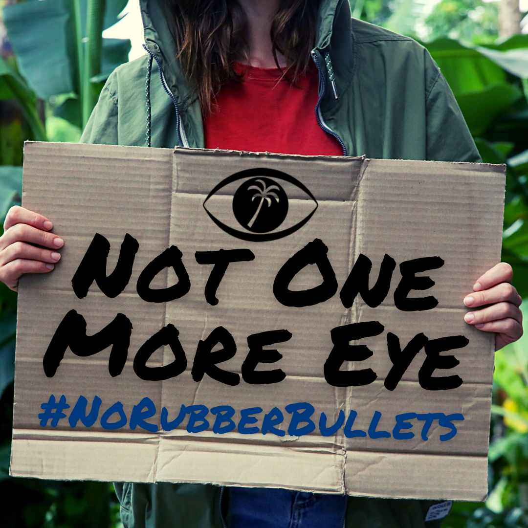 HawaiianEyeFNDN's tweet photo. Hawaiian Eye Foundation supports the ban of the use of rubber bullets. Using your voice should not mean losing your vision.
#notonemoreeye #norubberbullets #thisisourlane #aao #equlity #accountability #blm #pride #unity #aao #projectvisionhawaii #hawaiianeyefoundation https://t.co/EbT5YTtRxT