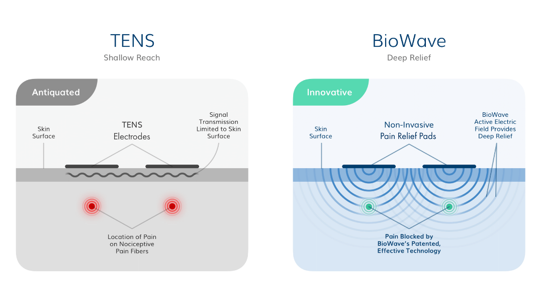 BiowaveCorp's tweet photo. BioWave's #patented #painblocking technology is unlike any #TENS device, working to deliver therapeutic electrical signals through skin into deep tissue to #pain nerves blocking the pain signal to the brain. Learn more about the BioWave difference at https://t.co/uUoHQ8NRVk https://t.co/PwKusCgoLL