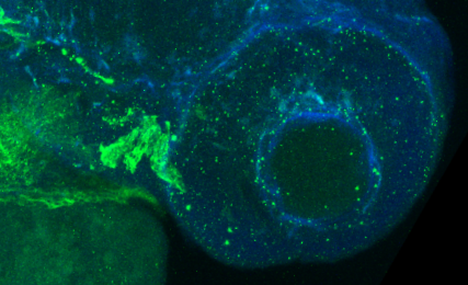 timothy_fuqua's tweet photo. Do any #zebrafish people know what this large green structure is just behind the developing eye? This is a #Pax7 antibody (green) co-stained with DAPI (blue). I think the green speckles are neural crest cells... Obvious wrong answers are also welcome ;) #evodevo https://t.co/ebKL9XnmlG