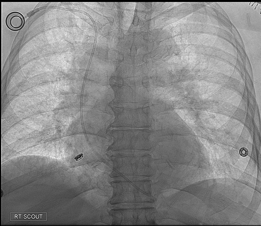 Peder E. Horner, MD Interventional Physician tweet media