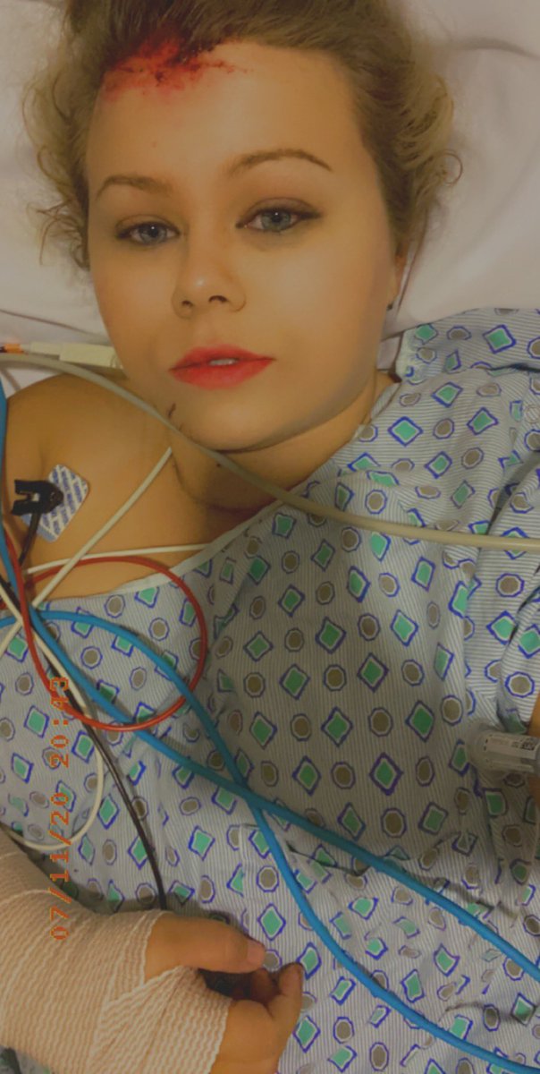 utopianprism's tweet photo. I’m broken as fuck but glad to be alive 🖤 #motorcycleaccident https://t.co/49LJ0uL7g3