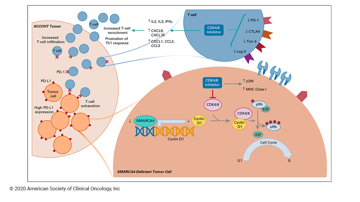JCO_ASCO's tweet photo. Combined CDK4/6 and PD-1 Inhibition in Refractory SMARCA4-Deficient Small-Cell Carcinoma of the Ovary, Hypercalcemic Type https://t.co/BNiFyiGURR #gyncsm #JCOPO https://t.co/H3k9AAKv81