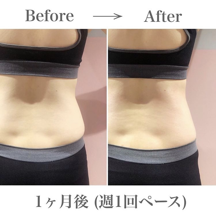 定額制セルフエステ Body Archi ボディアーキ お腹や腰まわりの脂肪が気になるという方 多いですよね マシンを写真のように持ってお腹から腰までしっかりかけてあげましょう フォースカッター は脂肪にアプローチするだけでなく 冷え症の改善や 定額制セルフエステ Body Archi ボディアーキ お腹や腰まわりの脂肪が気になるという方 多いですよね マシンを写真のように持ってお腹から腰までしっかりかけてあげましょう フォースカッター は脂肪にアプローチするだけでなく 冷え症の改善や