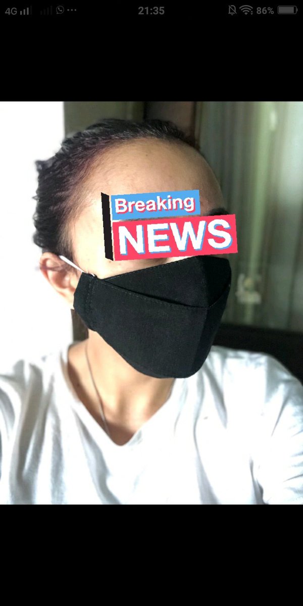 washablemaskCo's tweet photo. Assalamualaikum moms! Ini testimoni masker dewasa 2ply+vasilin dan kain bagian luar menggunakan kain teknologi water resistant😍 dijamin termurah nih moms masker 3D cuma 15K aja😘

#maskermalang #masker3d #jualmasker #malang #COVID19 #maskerkain #masker https://t.co/uADpAcSV7J