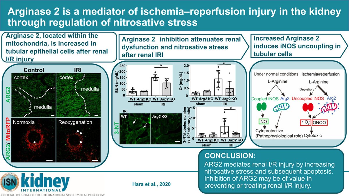 #GraphicalAbstract 
doi.org/10.1016/j.kint…
@KyushuUniv_EN #AKI #IschemiaReperfusion