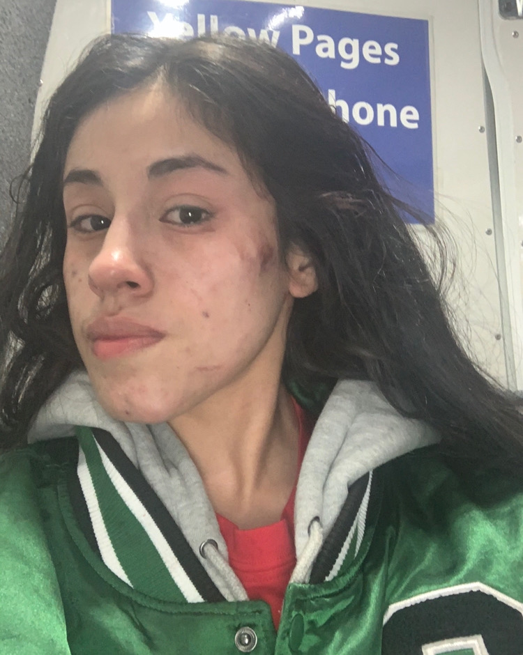 Mariah suffered bruises and cuts in multiple places on her face, bloodshot eyes, a gash on the top of her head, injuries on her hand and leg. Some images later taken by police...