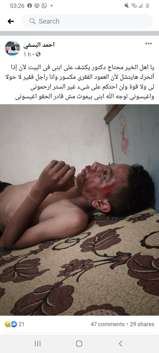 AhmedFranko18's tweet photo. ياجماعه الاب دا من بنى سويف وابنه عمل حدثه وعندو كسر فى العمود الفقرى ياريت اى دكتور يتولى الحاله دا طلب الاب وأكونته موجود فى الصوره يارب https://t.co/XmJmzC8EIm