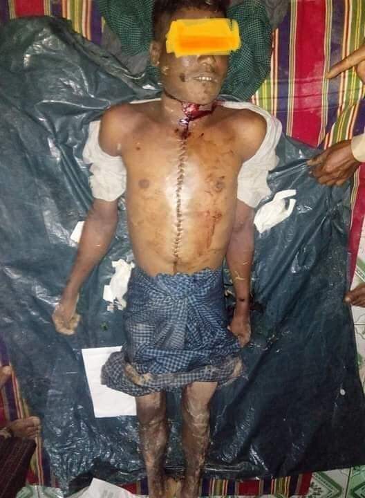 ChitthuSky's tweet photo. On 14/07/2020 family members brought his corpse from Burmese (Myanmar) forces’s Light Infantry Division No.34&amp; https://t.co/PUlqg7i2Mu members of other 5 detainees are very worried about the fate of their loved https://t.co/zZXl8pQnpe strongly condemns Burmese army’s barbaric ac https://t.co/lMqtX4bdGP