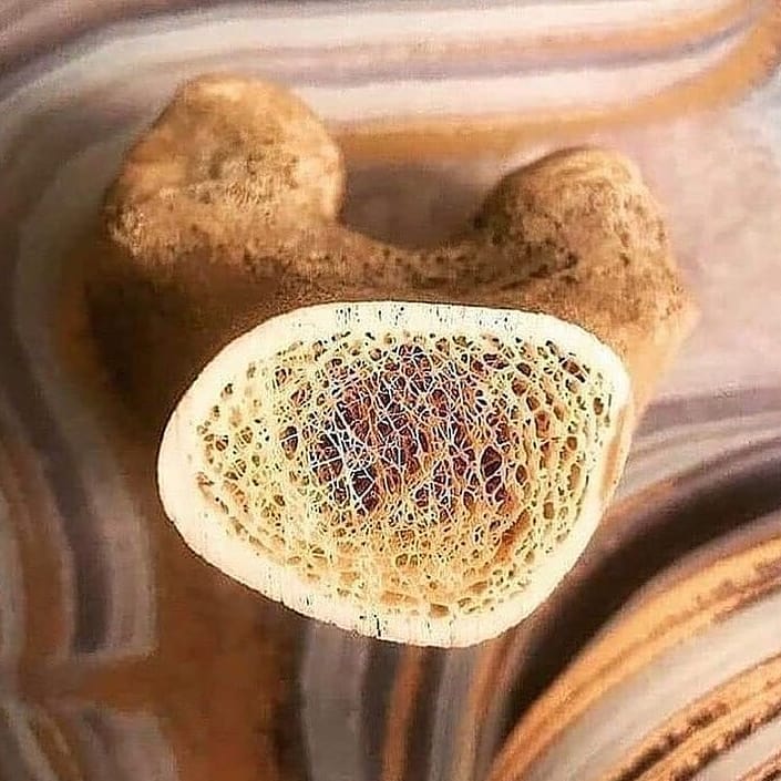 RIPTGroup's tweet photo. Cross-section view of femoral head.
#riptgroupofinstitutions #rcphs #pbson #rcps https://t.co/84untbQEgm