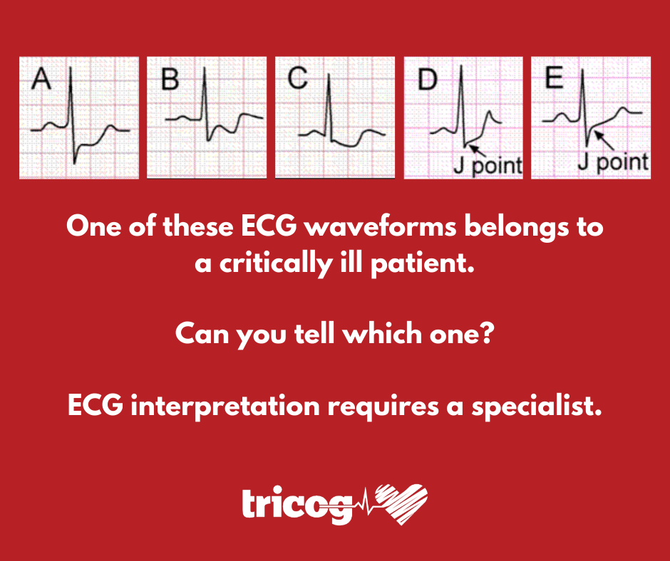 tricoghealth's tweet photo. Can you find which one is the Critical ECG from below options?
#SaveLives #CardiacSolution #ECGSolution #ECGquiz https://t.co/ELJAnDX9Wq