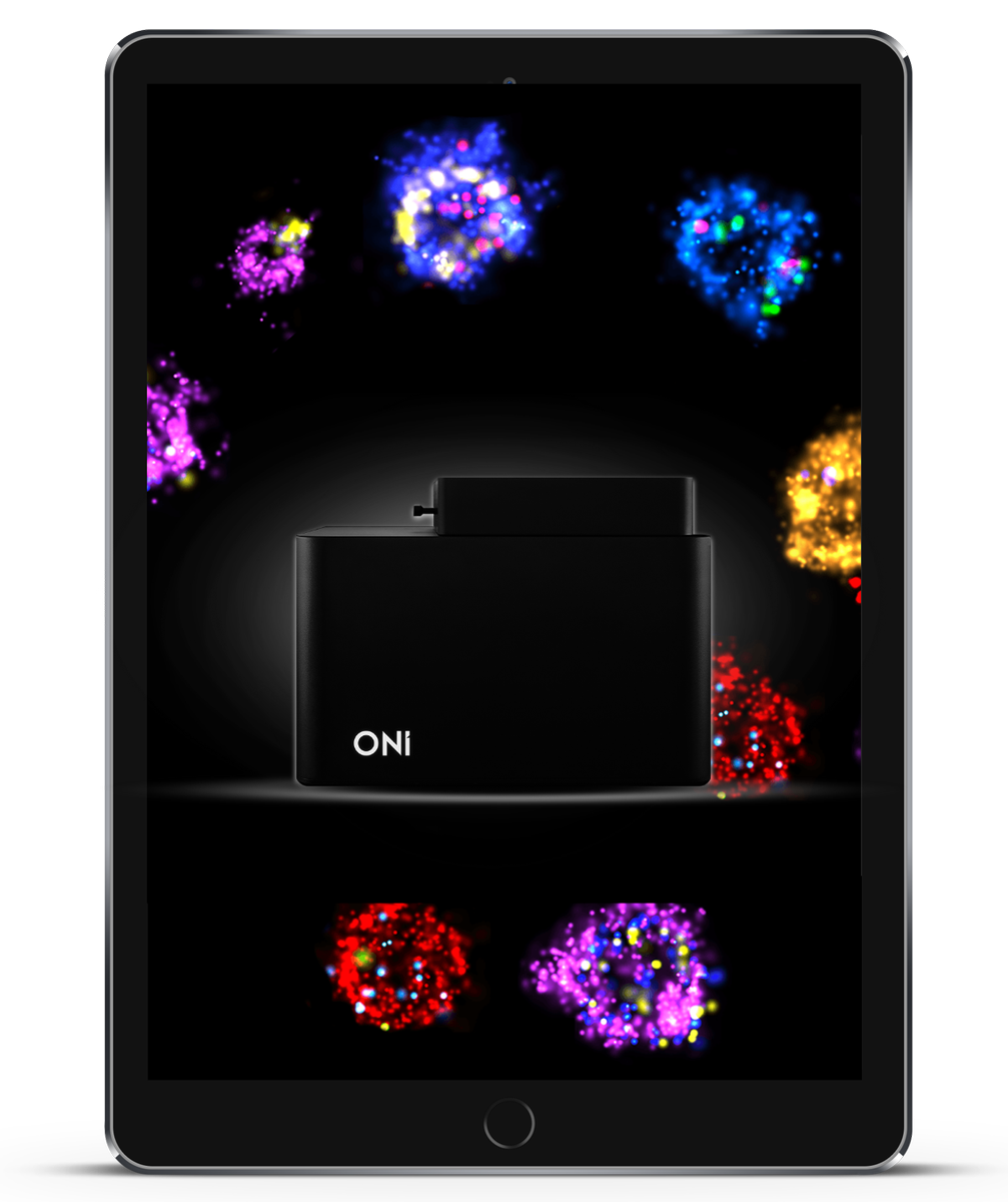 oniHQ's tweet photo. We have some very exciting EV data to share and cannot wait to show you all our advances in #ExtracellularVesicle characterizationโจ. If you are attending #ISEV2020 , come and see our poster! And ask @siobhanking6 a question for a chance to ๐ an iPad! ๐https://t.co/xd1cjen95I https://t.co/xKcDg3W8as